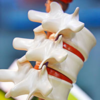 estenose vertebral